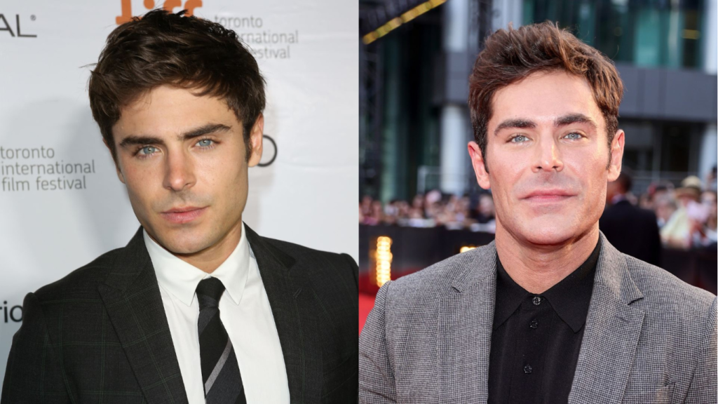 Zac Efron Plastic Surgery